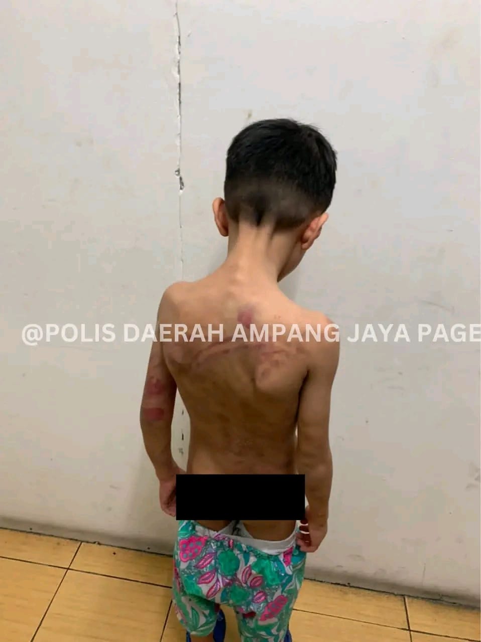 Dera kanak-kanak: Ibu saudara, suami direman - Polis