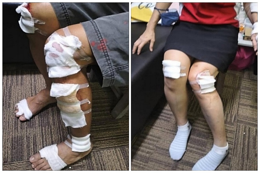 Suspek samun ragut ditahan tak sampai 3 jam selepas polis terima laporan